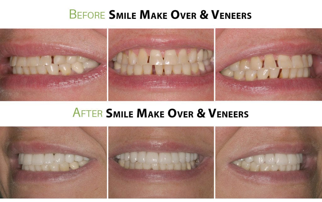 How to Improve Your Smile Asheville Holistic Dentist