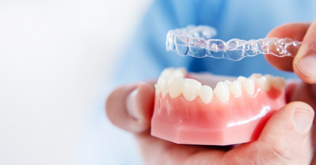 A person wearing blue clothing places a transparent orthodontic aligner on an artificial mold of a person's upper teeth.