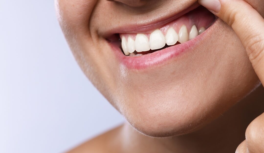 An extreme close-up of the lower half of a person's face. They're smiling and pulling their upper lip to show their gums.