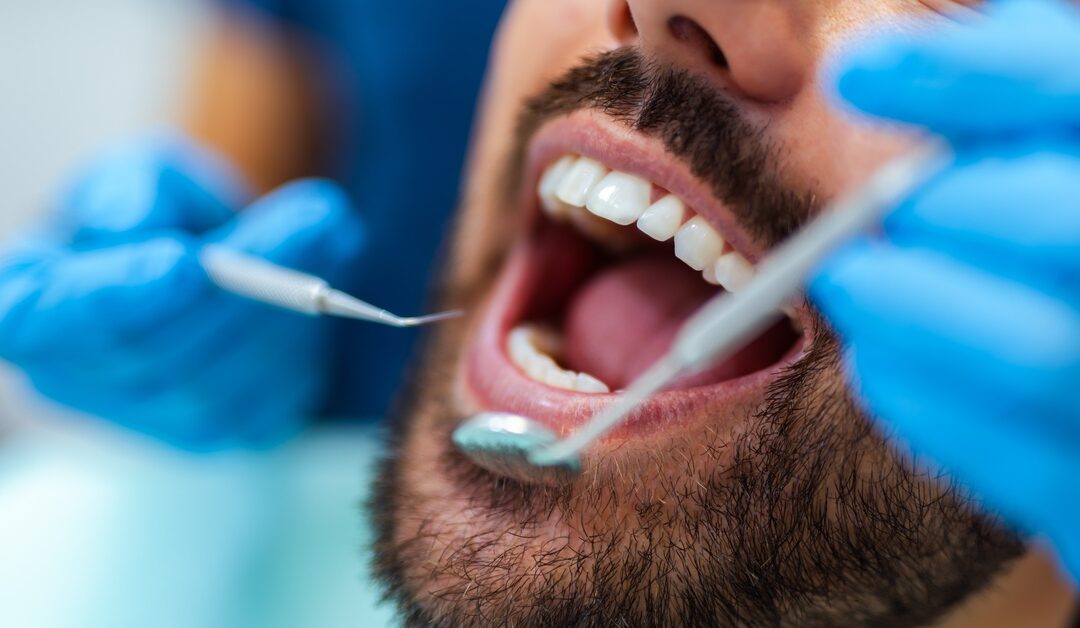 A close-up of a man's mouth wide open as a dentist wearing gloves holds a dental explorer and mirror in their hands.