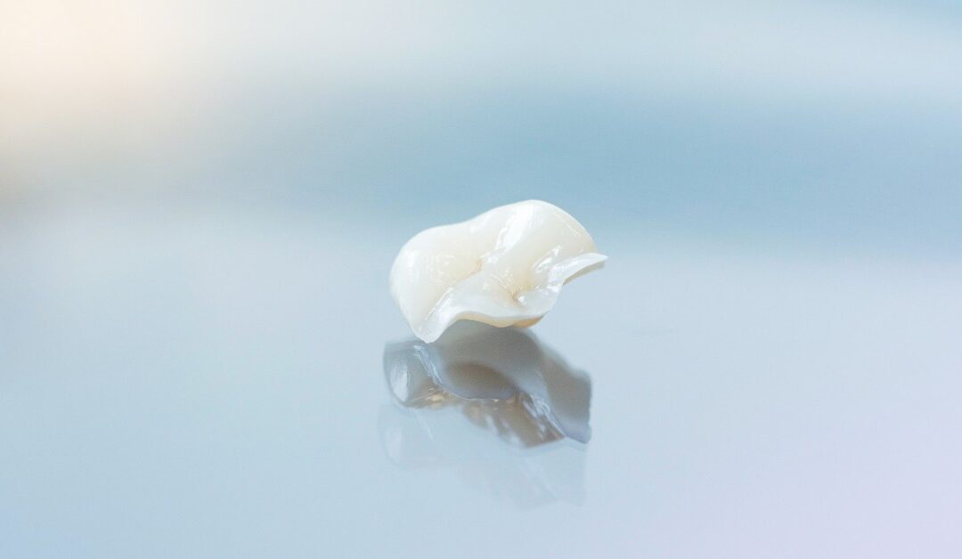 A close-up of a bright white ceramic inlay lying on a glass surface with a blue hue. Light reflects onto the glass.