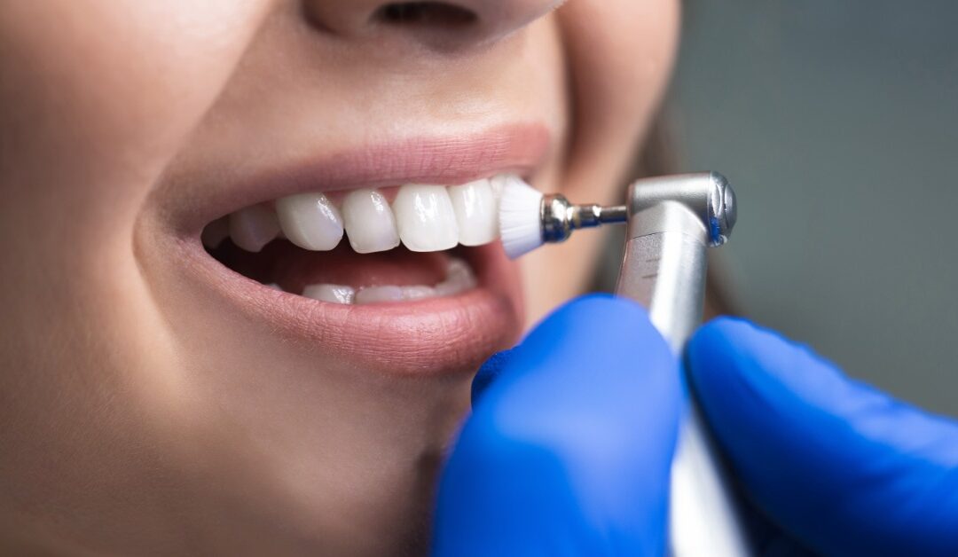 A close-up of a woman holding her mouth open. A dentist wearing blue gloves holds a dental mirror and a pick near her teeth.