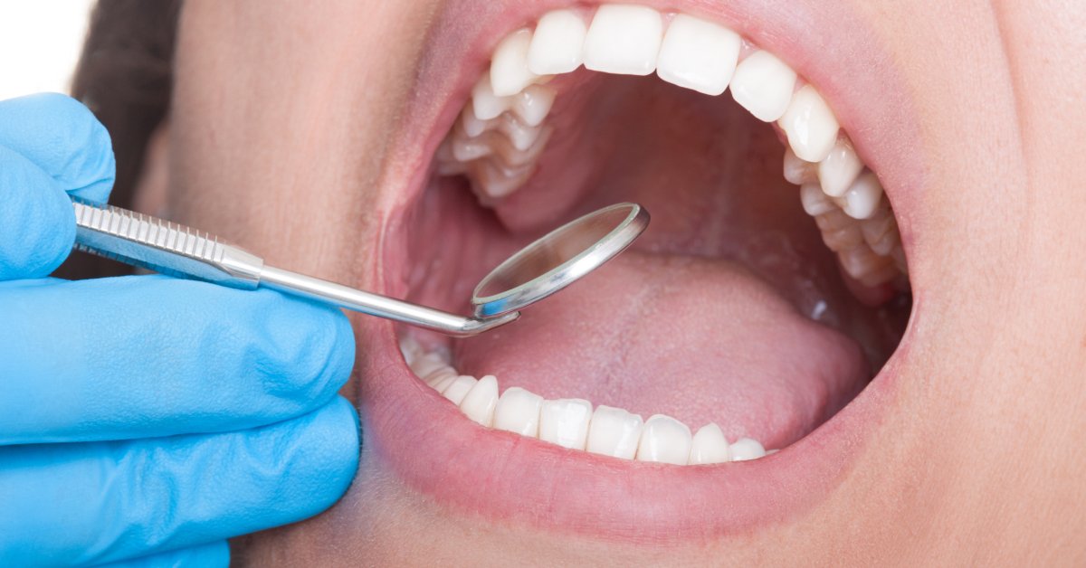 A close-up view of a person with their mouth open while sitting in a dental chair. A gloved hand inspects the teeth and gums.
