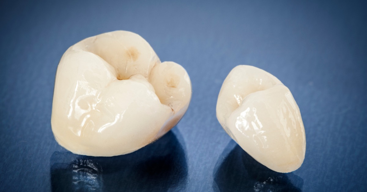  A close-up of two ceramic dental crowns resting on a dark blue reflective surface. Shadows form below the crowns.