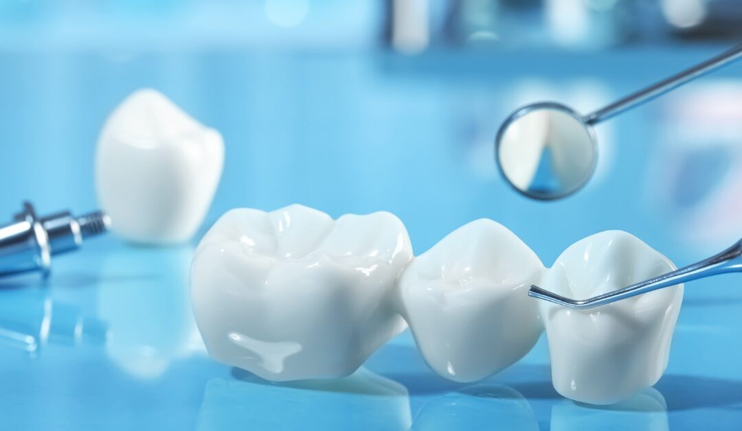 A close-up of white dental crowns lying on a blue surface with metal dental tools and a mirror nearby.