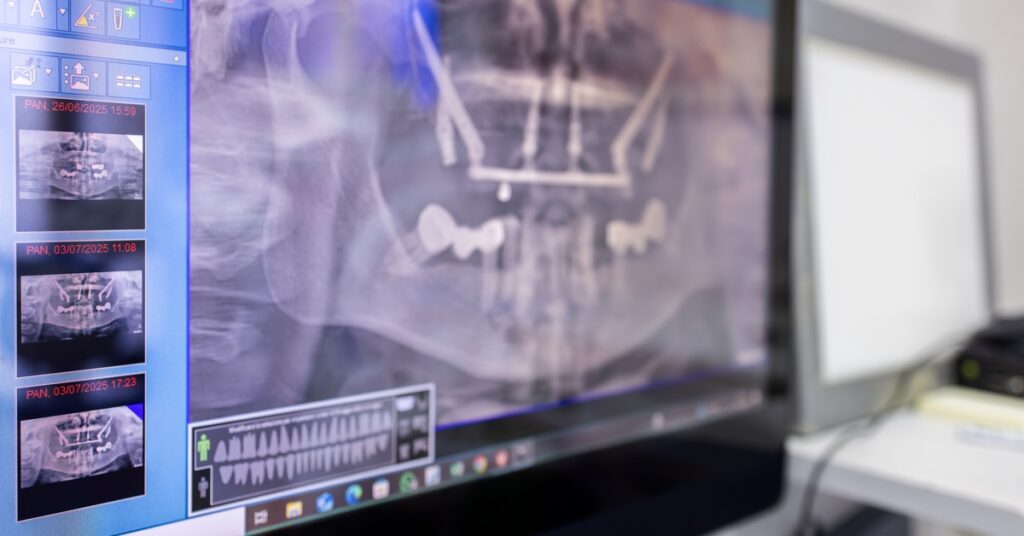 A computer monitor displaying panoramic jaw radiographs and dental imaging software in a dental office.