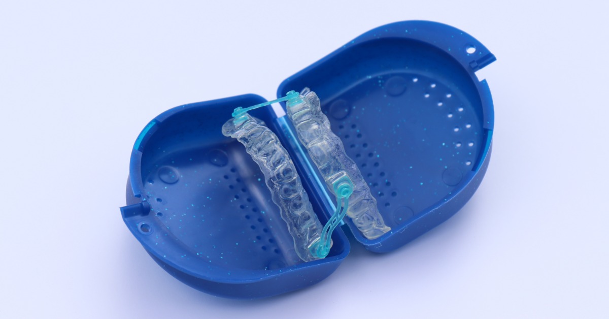 A clear oral appliance with light blue connectors is sitting in an open, royal blue retainer case on a white surface.