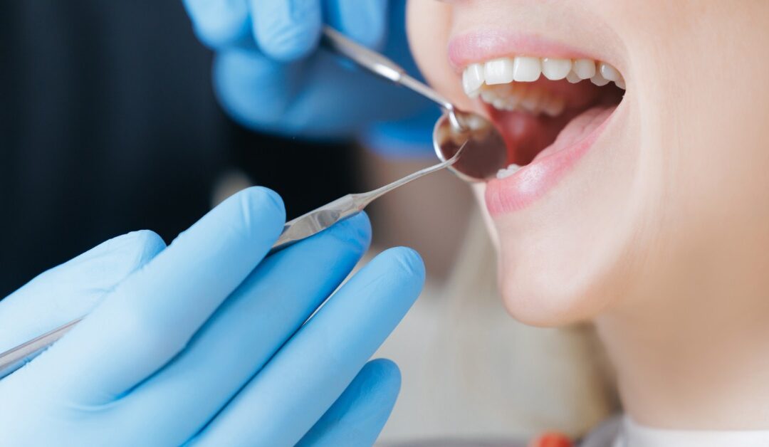 A close-up of a patient holding their mouth open as a dentist uses a dental mirror and probe to inspect the teeth.