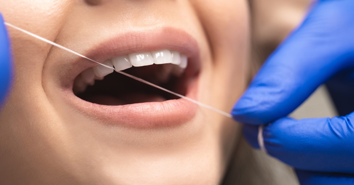 A close-up of a person holding their mouth open slightly as a hands wearing blue gloves pull floss between the front teeth.
