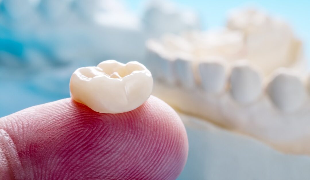 A white dental crown is positioned on a person's fingertip. A dental model is blurred in the background.