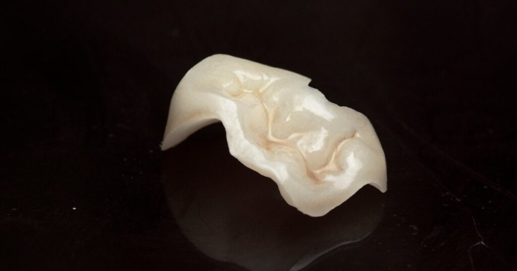 A cream-colored dental onlay is resting on a glossy, reflective black surface. The onlay has defined grooves.