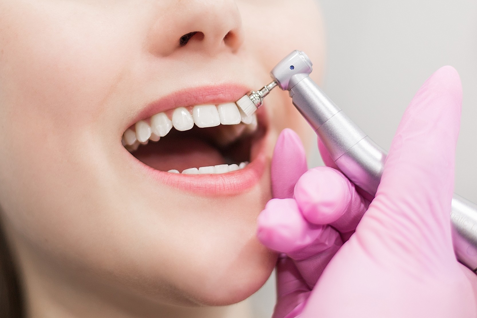 Keep your smile healthy with Teeth Cleaning